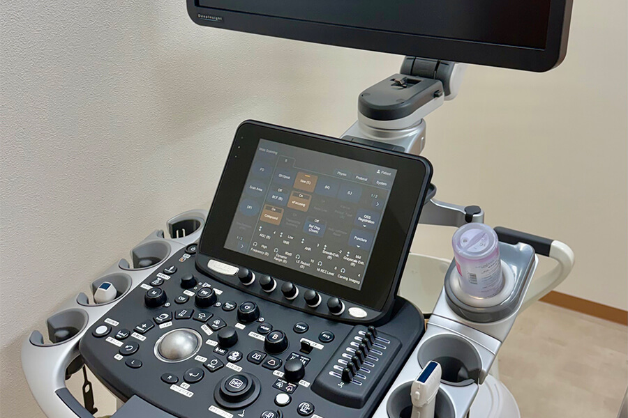 超音波診断装置